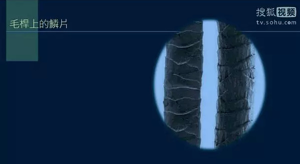 Scales on the hair shaft